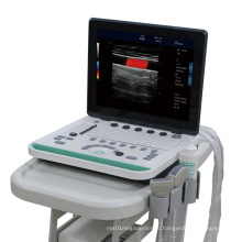 C5Pre Portable Laptop Color Doppler Ultrasound Machine